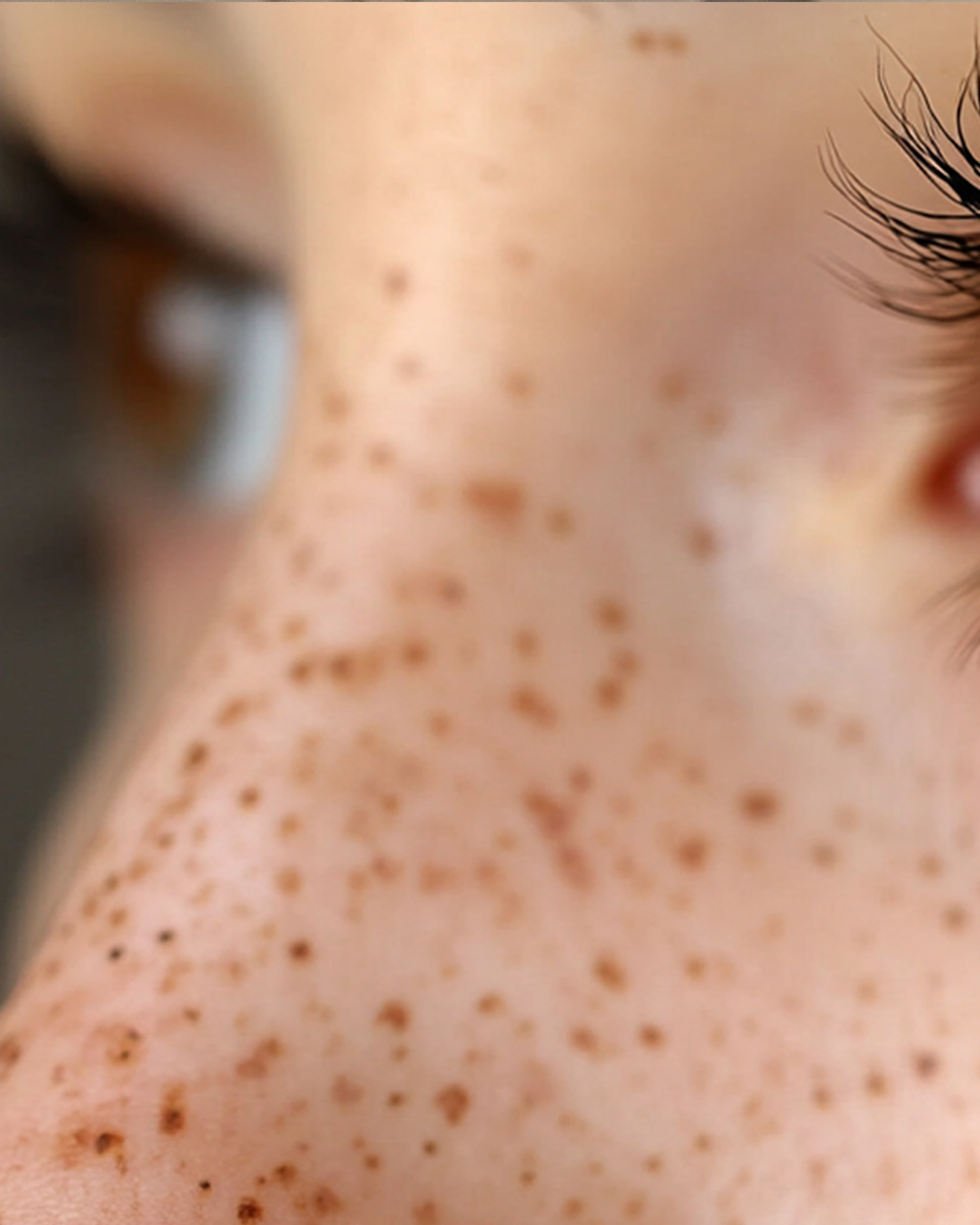 Pecas